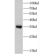 WB analysis of HeLa cells, using DIMT1L antibody (1/1500 dilution).