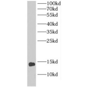 WB analysis of A549 cells, using DIO1 antibody (1/1000 dilution).