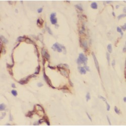 DIRAS Family, GTP-Binding RAS-Like 1 (DIRAS1) Antibody