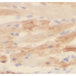 Dickkopf 2 Homolog (Xenopus Laevis) (DKK2) Antibody