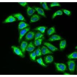 Dihydrolipoyl Transacetylase (DLAT) Antibody