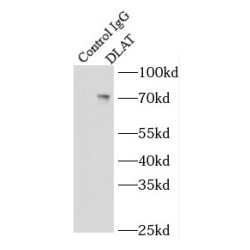 Dihydrolipoyl Transacetylase (DLAT) Antibody
