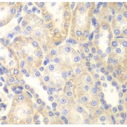 Rho GTPase-Activating Protein 7 (DLC1) Antibody
