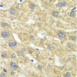 Dihydrolipoyl Dehydrogenase, Mitochondrial (DLD) Antibody