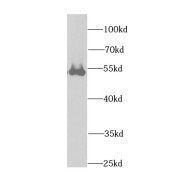 WB analysis of human liver tissue, using DLD antibody (1/1000 dilution).