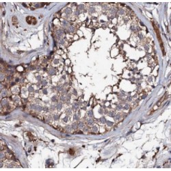 Deleted In Lung And Esophageal Cancer 1 (DLEC1) Antibody