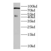 WB analysis of human testis tissue, using DLEC1 antibody (1/300 dilution).