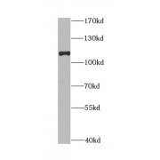 WB analysis of mouse lung tissue, using DLG1 antibody (1/1000 dilution).