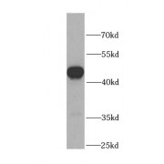 WB analysis of mouse placenta tissue, using DLK1 antibody (1/1000 dilution).