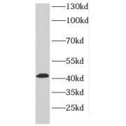 WB analysis of mouse brain tissue, using DLK2 antibody (1/500 dilution).