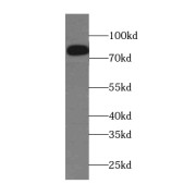 WB analysis of human placenta tissue, using DLL1-Specific antibody (1/500 dilution).
