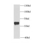 WB analysis of HeLa cells, using DMAP1 antibody (1/1000 dilution).
