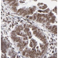 Meiotic Recombination Protein DMC1/LIM15 Homolog (DMC1) Antibody