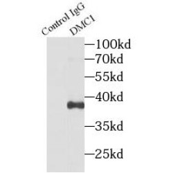 Meiotic Recombination Protein DMC1/LIM15 Homolog (DMC1) Antibody
