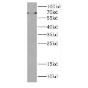 WB analysis of mouse liver tissue, using DMRTA1 antibody (1/600 dilution).