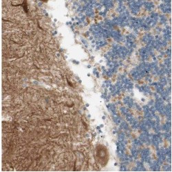 DmX-Like Protein 2 (DMXL2) Antibody