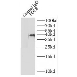 DNA polymerase beta Antibody
