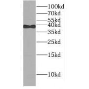 WB analysis of K-562 cells, using POLB antibody (1/1000 dilution).
