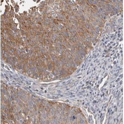 DNA Replication ATP-Dependent Helicase/Nuclease DNA2 (DNA2) Antibody