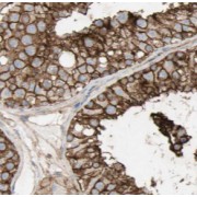 IHC-P analysis of human testis tissue, using DNAH14 Antibody (1/50 dilution).