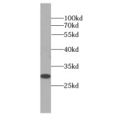 WB analysis of mouse testis tissue, using DNAJB3 antibody (1/800 dilution).
