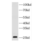 WB analysis of HeLa cells, using DNAJB8 antibody (1/500 dilution).