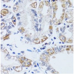 DnaJ (Hsp40) Homolog, Subfamily C, Member 19 (DNAJC19) Antibody