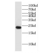 WB analysis of mouse testis tissue, using DNAJC5B antibody (1/1500 dilution).