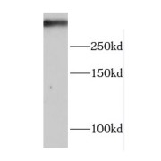 WB analysis of HeLa cells, using DNA-PKcs antibody (1/300 dilution).