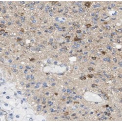 Dynamin 3 (DNM3) Antibody