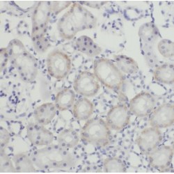 Docking Protein 8 (DOCK8) Antibody