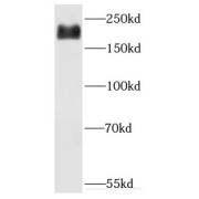 WB analysis of A549 cells, using DOCK9 antibody (1/500 dilution).