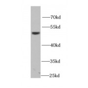 WB analysis of MCF7 cells, using DOK1 antibody (1/1000 dilution).