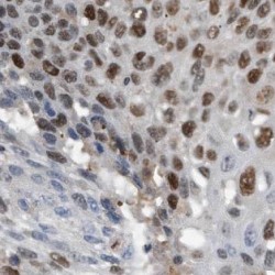 D4, Zinc And Double PHD Fingers Family 2 (DPF2) Antibody