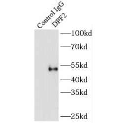 D4, Zinc And Double PHD Fingers Family 2 (DPF2) Antibody