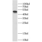 WB analysis of Apoptosised HeLa cells, using DPF2 antibody (1/300 dilution).