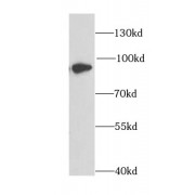 WB analysis of MCF7 cells, using DPP3 antibody (1/1000 dilution).