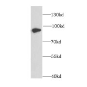 WB analysis of MCF7 cells, using DPP3 antibody (1/1000 dilution).