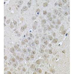 Down Regulator Of Transcription 1, TBP Binding (DR1) Antibody