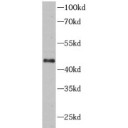WB analysis of Jurkat cells, using DR5-Specific antibody (1/500 dilution).