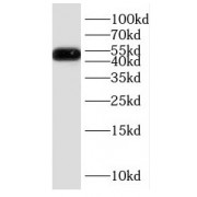 WB analysis of mouse brain tissue, using DRD1 antibody (1/300 dilution).