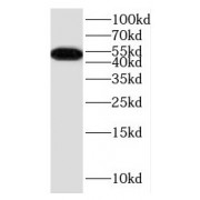 WB analysis of mouse brain tissue, using DRD5 antibody (1/500 dilution).