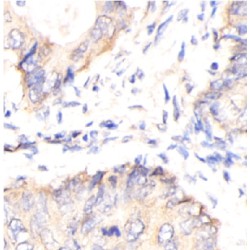 Dynamin-1-Like Protein (DRP1) Antibody