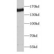 Western blot analysis of HeLa cells using Desmoglein 2 Antibody (1/1000 dilution).