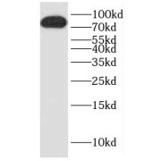 WB analysis of MCF-7 cells, using DTX3L antibody (1/600 dilution).