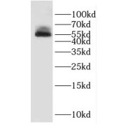WB analysis of Jurkat cells, using DUS1L antibody (1/1500 dilution).