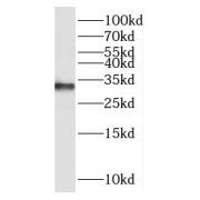 WB analysis of A375 cells, using DUSP15 antibody (1/300 dilution).