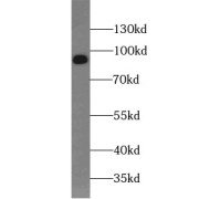 WB analysis of HepG2 cells, using DVL2 antibody (1/1000 dilution).