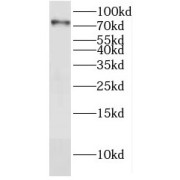 WB analysis of HEK-293 cells, using Dymeclin antibody (1/ dilution).