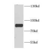 WB analysis of mouse brain tissue, using DYNC1I1 antibody (1/1000 dilution).